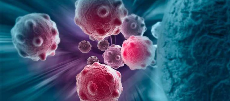 BioMark trabalha em novos dispositivos para diagnóstico precoce do cancro